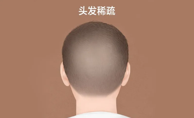 1600664778131548.png image.png